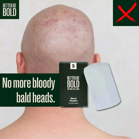 Better Be Bold Blood Stopper for Bald Heads - Sensitive Scalp - RoyalBeards